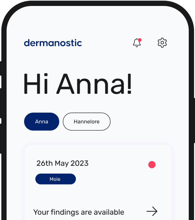 App Mockup: beginscherm