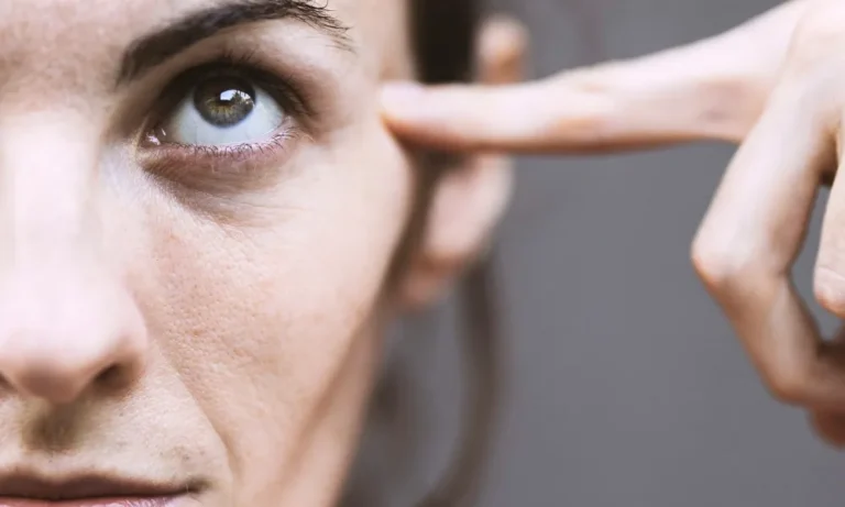 Augenlidekzem, Lidekzem, periorbitale Dermatits