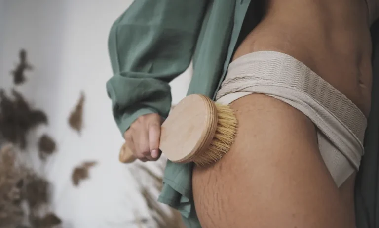 Was kann man gegen Dehnungsstreifen machen?