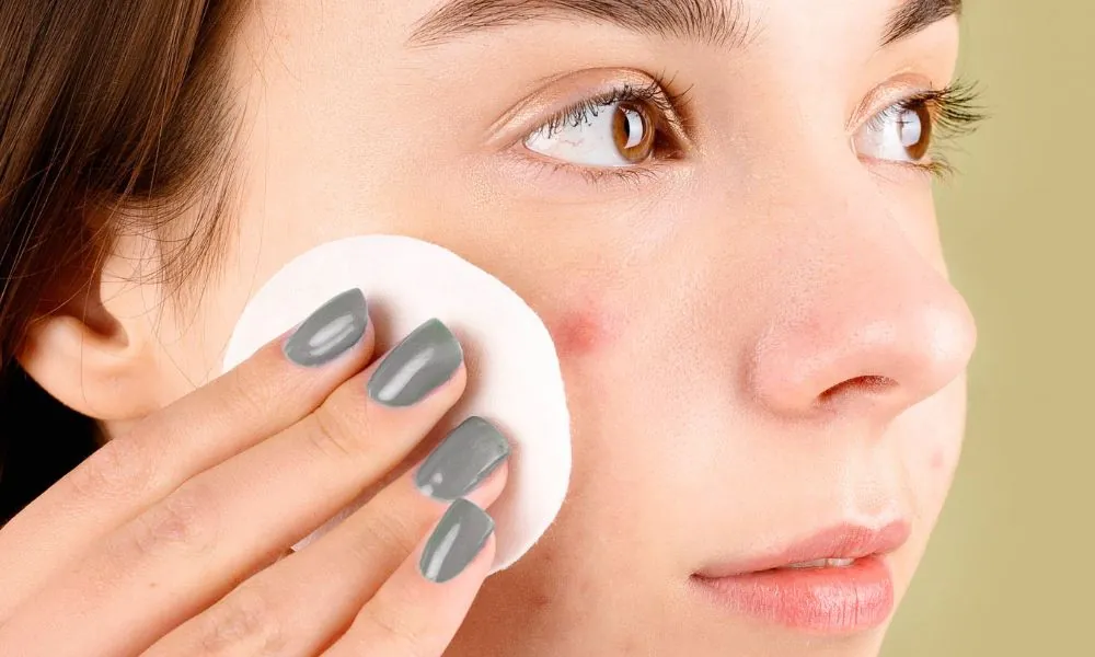 Akne, Hautpflege, Haut, Gesicht