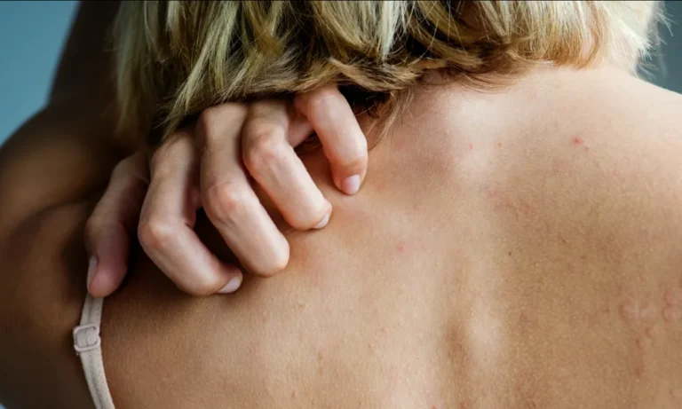 Frau kratzt sich am rücken