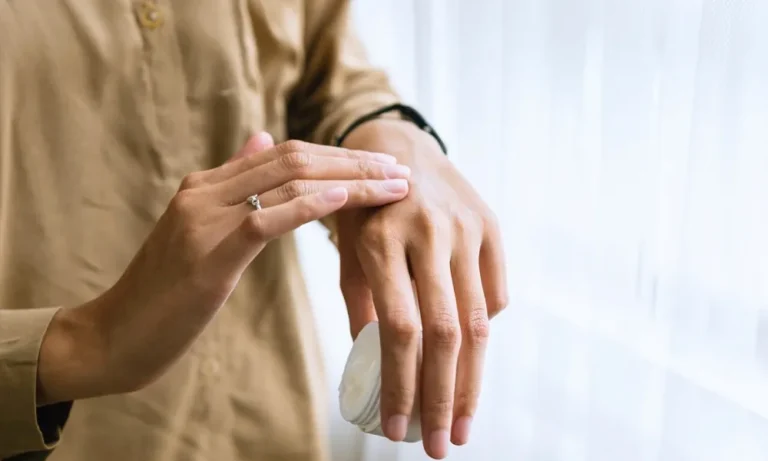 Kortison, Cortison, Hauterkrankungen, Kortisoncreme