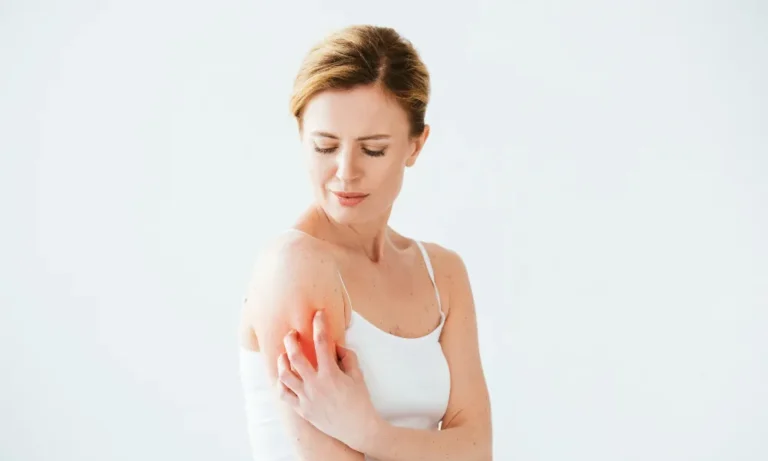 Foto einer Frau die ihre Haut am Oberarm kratzt, weil diese juckt.