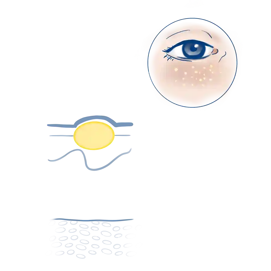 Illustration die Lage und Aufbau von Milien zeigen