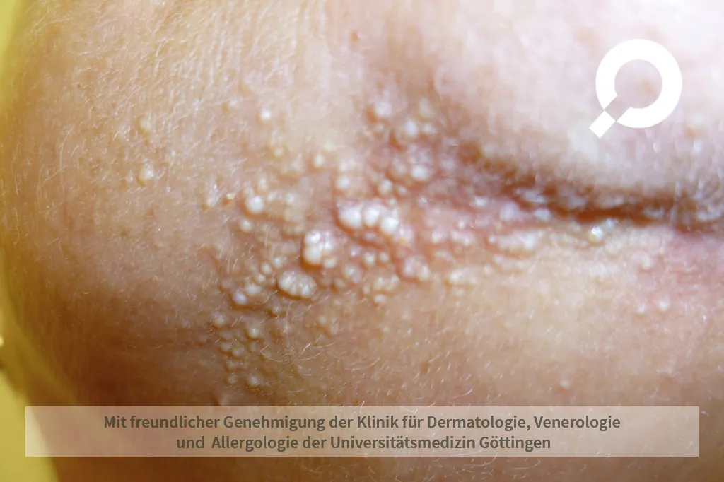 kleine weiße Punkte