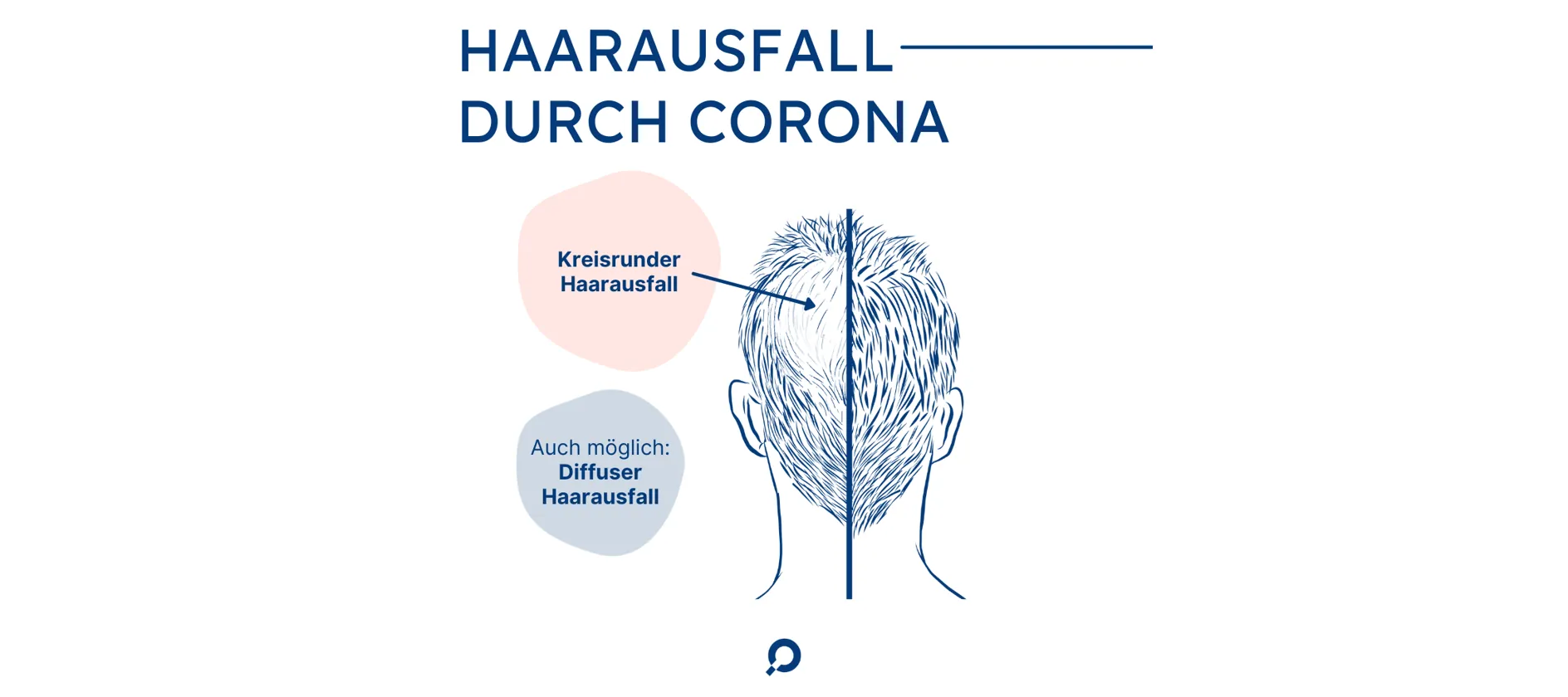 Haarausfall durch Corona 