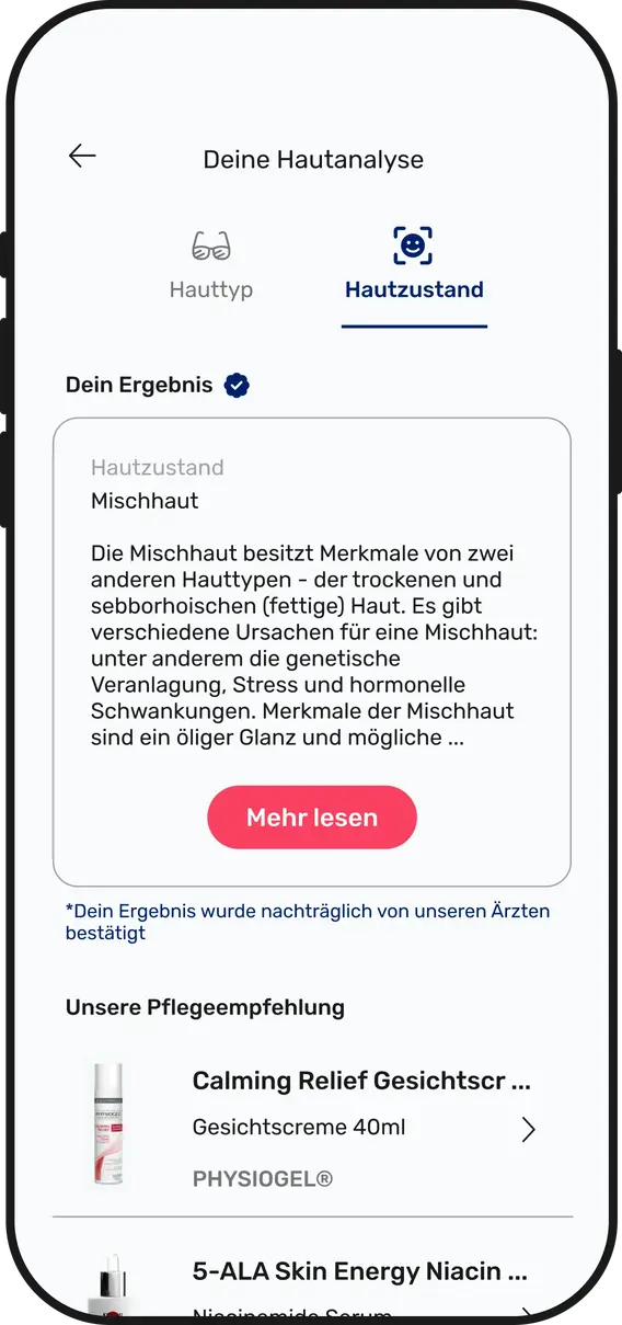 Handy Mockup unserer Hautanalyse KI in der App